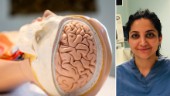 Unik studie om coronas inverkan på hjärnan